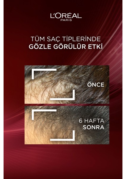 Elseve Komple Direnç Bakım Kremi 250 ml