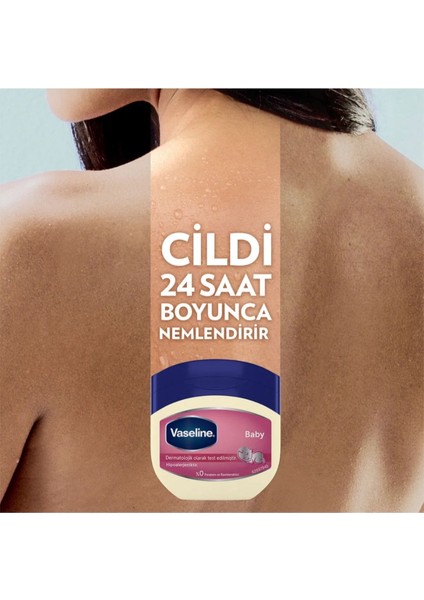 Vaseline Nemlendirici Jel Baby 100 ml fırsatları