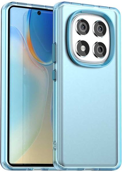 Redmi Note 14 Pro Pc + Tpu + Pet Mat Düşmeye Karşı Telefon Arka Kapağı (Yurt Dışından)