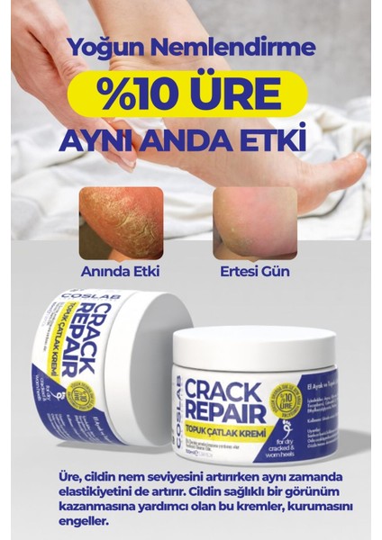 %10 Üreli Ayak Topuk Çatlak ve Koku Giderici Nemlendirici Bakım Kremi 2’li Paket 2X100ML indirimleri