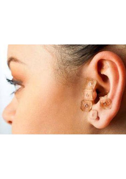 Akupunktur Kulak Tohumları 600 Adet Vaccaria Masajı Akupunktur Faydaları fırsatları