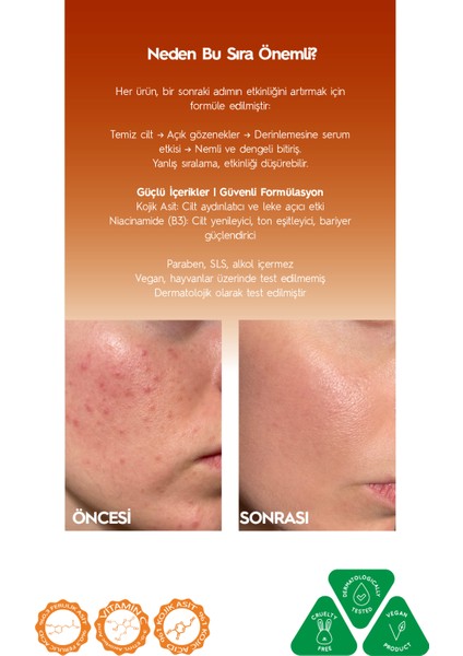 Kojik Asitli 3'lü Leke Karşıtı Bakım Seti | Yüz Temizleme Jeli 250 ml + Serum 30 ml + Krem 50 Ml fiyatları