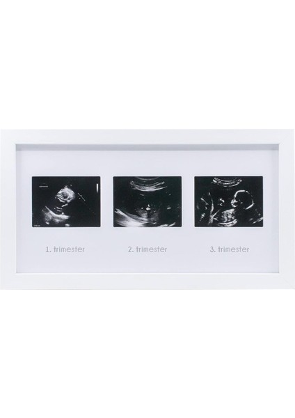 Üçlü Ultrason Anı Çerçevesi - Gebelikte Bebeğin Gelişimini Üç Trimester Anı Ola