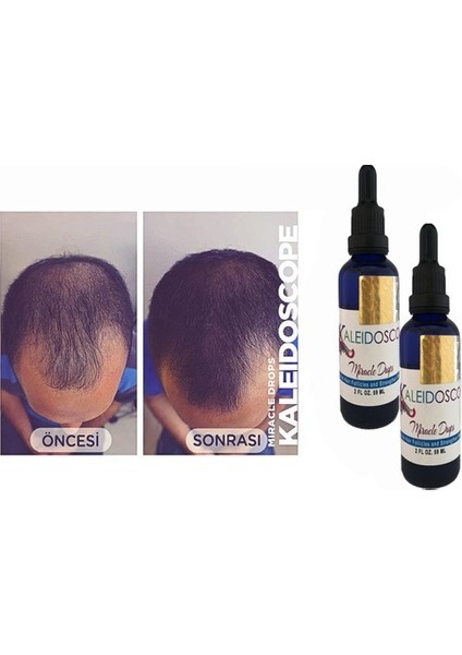Miracle Drops Saç Bakım Yağı