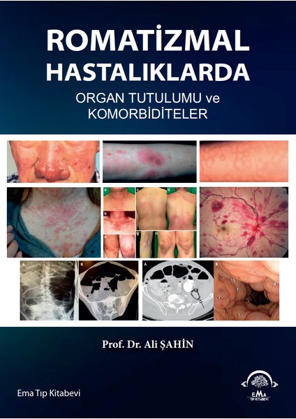 Romatizma1 Hastalıklarda Organ Tutulumu ve Komorbiditeler