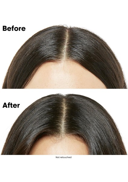 Paris Serie Expert Scalp Advanced Hassas Saç Derisi İçin Profesyonel Şampuan 500 ml