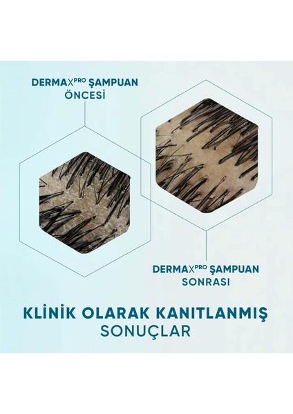 Dermaxpro Scalp & Hair Revitaliser Dökülme ve Şampuan Kafein ve Seramid ile 300ML