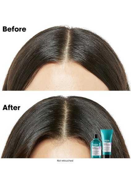Paris Serie Expert Scalp Advanced Hassas Saç Derisi İçin Profesyonel Refill Şampuan 500 ml