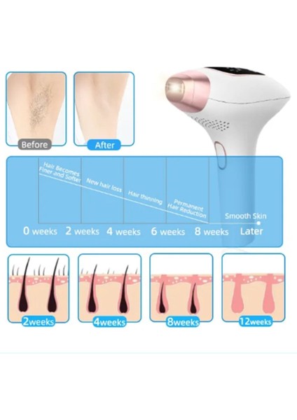 Nwn-4 Acısız Ipl Buz Lazer Epilasyon - Tüm Vücut - Tüm Ten Renkleri ile Uyumlu