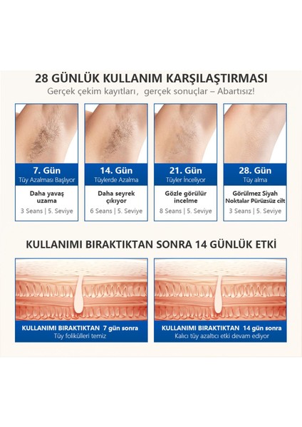 -T16 (Hr Bk Fa) Yakut Mavi Renk Ev Tipi Lazer Epilasyon Cihazı 0 Olumsuz Yorum! fırsatları