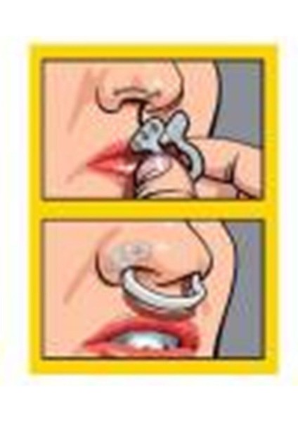 Rahatsızlık Hissini Azaltan Orta Boy Burun Açıcı Aparat fiyatları