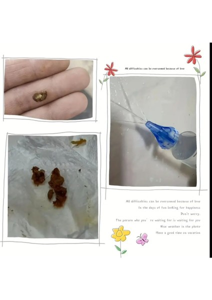 Yıwu 1 Set Polipropilen Kulak Irrigasyon Sistemi, Evrensel Kulak Yıkama Bakım Kırmızı modelleri