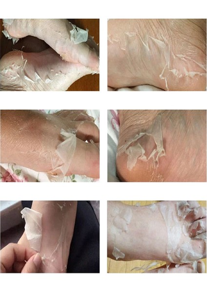 Ayak Peeling Maskesi – Nasır, Ölü Deri, Giderici, Nemlendirici Lavanta Özlü Maske modelleri