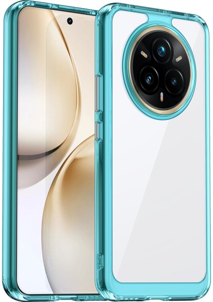 Realme P3 Pro 5g/14 Pro+5g Kılıf Tpu+Akrilik Koruyucu Şeffaf Telefon Kılıfı-Şeffaf Mavi (Yurt Dışından)