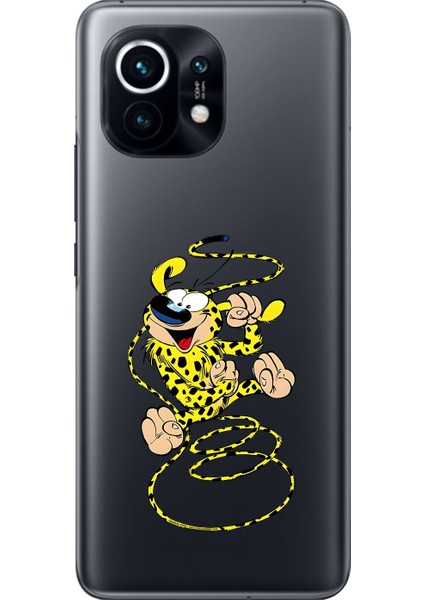 Xiaomi Mi 11 Uyumlu Şeffaf Kılıf Cartoon 9 Tasarımlı