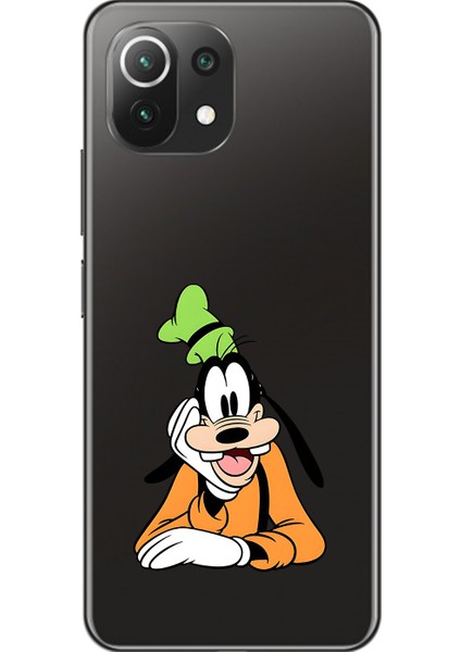 Xiaomi Mi 11 Lite Uyumlu Şeffaf Kılıf Cartoon 5 Tasarımlı