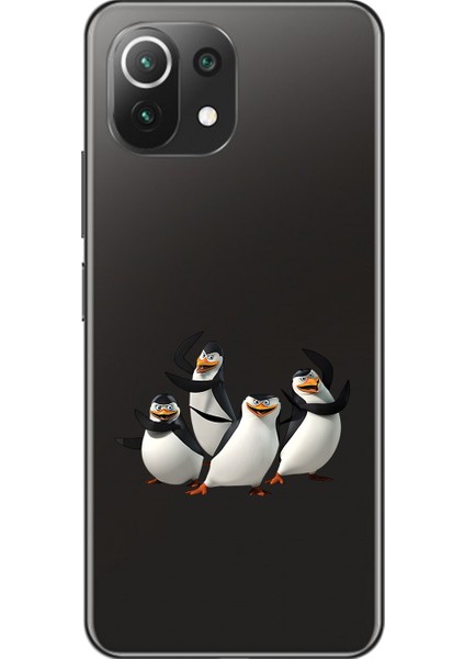 Xiaomi Mi 11 Lite Uyumlu Şeffaf Kılıf Cartoon 8 Tasarımlı