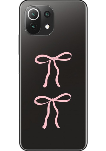 Xiaomi Mi 11 Lite Uyumlu Şeffaf Kılıf Kurdele 1 Tasarımlı