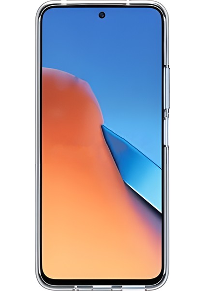 Xiaomi Redmi Note 13 Pro Uyumlu Şeffaf Kılıf 1905 Aslan Tasarımlı