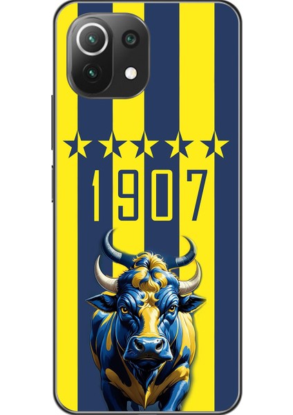 Xiaomi Mi 11 Lite Uyumlu Şeffaf Kılıf 1907 Boğa Tasarımlı