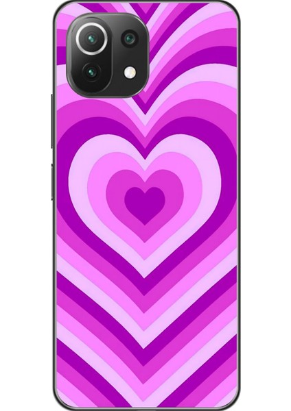 Xiaomi Mi 11 Lite Uyumlu Şeffaf Kılıf Kalp 2 Tasarımlı
