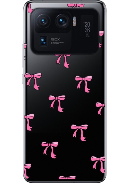 Xiaomi Mi 11 Pro Uyumlu Şeffaf Kılıf Kurdele 3 Tasarımlı