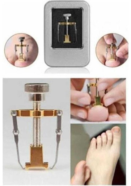 Batik Tırnak Aparatı ile Bakım ve Güzellik İçin Güçlü Çözüm