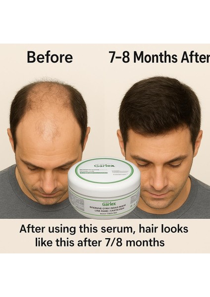 Yoğun Bakım Saç Maskesi/Keratin&Argan,Bıttım Yağlı ve C&E vitaminli Premium Seri 250 ml