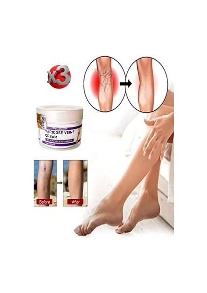 Varicose Veins Purple Krem Sılulıt ve Karsıtı 100 ml x 3 Ad