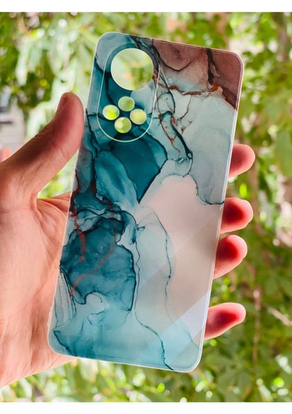 Huawei Nova 9 Kılıf Mermer Desenli Baskılı Silikon