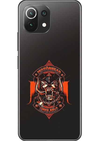 Xiaomi Mi 11 Lite Uyumlu Şeffaf Kılıf Motörhead Tasarımlı