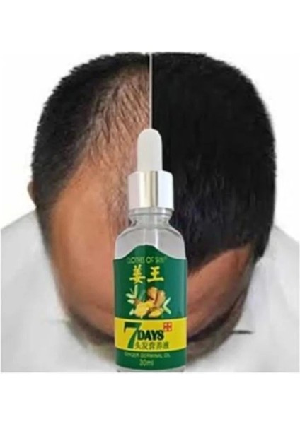 7 Days Ginger Germinal Essential Oil Hair Growth Loss Treatment Serum Unisex 30 ml 2 Adet modelleri