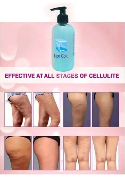 Lipo Cold Sıkılığa Inceliğe Hafifliğe ve Selülilitlerinize Güçlü Etkide Krem 250 ml x 2 Adet
