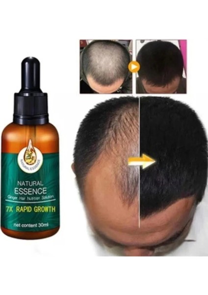 7x Rapid Natural Growth Hair Treatment Serum 60 ml Saç Bakım ve Onarıcı Serum 2 Adet fiyatları
