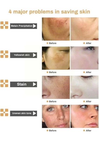 Kişisel Ecza White Factor For Instant Whitening Cilt Beyazlatıcı Masaj Bakım Kremi 120 ml x 2 Adet