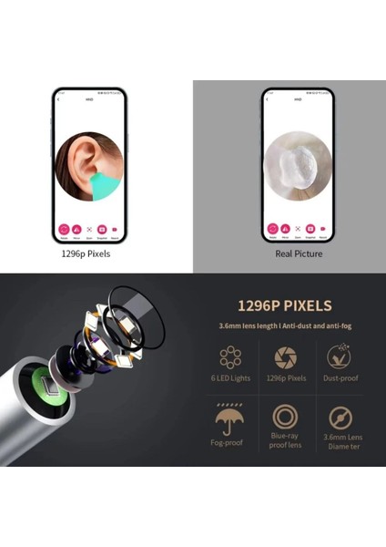 Kameralı Akıllı Görsel Kulak Temizleyici Otoskop 6 Ledli Wifi Usb-C Bağlantılı indirimleri