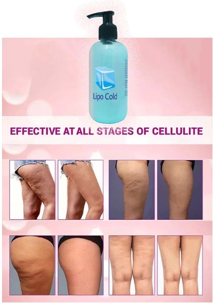 Lipo Cold Sıkılığınıza Inceliğinize Hafifliğinize Yeni Görünümünüze ve Selülilitlerinize Güçlü Krem 250 ml