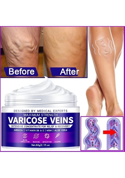 Maximum Strength Varicose Veins Krem 100 ml 1 Adt