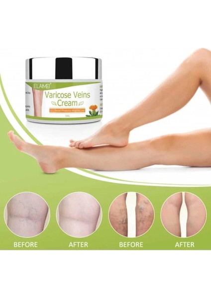 Spider Varicose Veins Cream Varis,selülit,diz,bacak Bakım Kremi 3 Adet - 100 ml