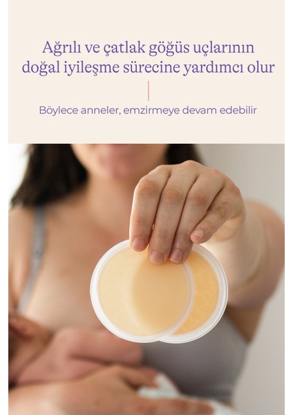 Soothies Soğutucu Hidrojel Pedleri – Göğüs Ucu Çatlak, Yara ve Ağrılarda Yenilikçi Çözüm fırsatları