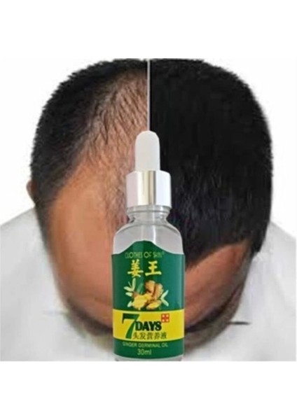 30 ml Hair Growth Loss Treatment Serum 2 Adet fiyatları