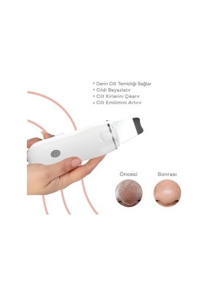 Ultrasonik Spatula Yüz Aknegiderici Siyah Nokta Temizleme Cihazı