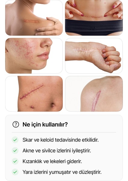 Skar Giderici Silikon Şerit Keloid Sezaryen Cilt Çatlakları Bbl Ameliyat Izi 1'li fiyatları