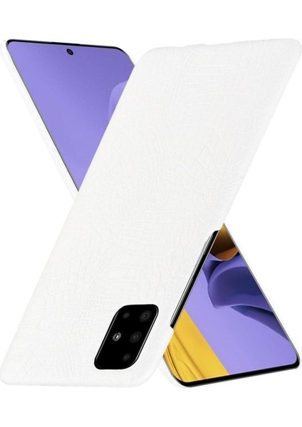 Samsung Galaxy M51 Klasik Timsah Moda Anti Için Şık Klasik Durumda (Yurt Dışından)