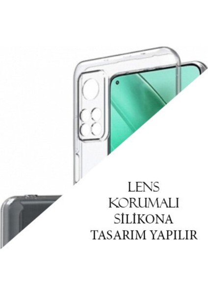Xiaomi Mi 10T Pro Kılıf Uv Baskılı Silikon Mi 10T Pro Kılıf - Chon