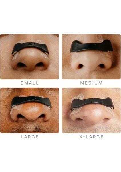 Manyetik Burun Açıcı Aparat (Nasal Dilator- Nefes Açar)