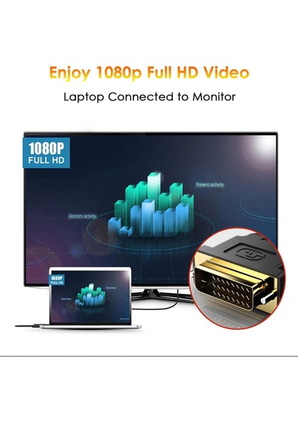 HDMI To DVI 24+5 DVI To HDMI Kablo Altın Uçlu Hdmı-Dvı Kablosu Erkek Tv Hd Pc Projektör Bilgisayar Monitör /ps3/ps4/ps5 Uyumlu Dönüştürücü Çevirici