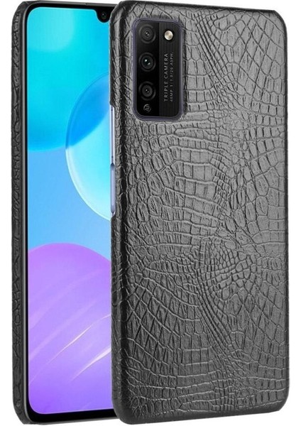 Honor 30 Youth Telefon Kılıfı (Yurt Dışından)