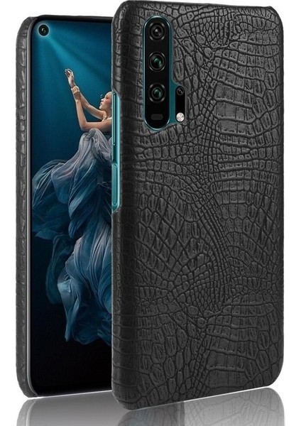 Onur 20 Pro Klasik Timsah Moda Koruyucu Için Şık Klasik Durumda (Yurt Dışından)