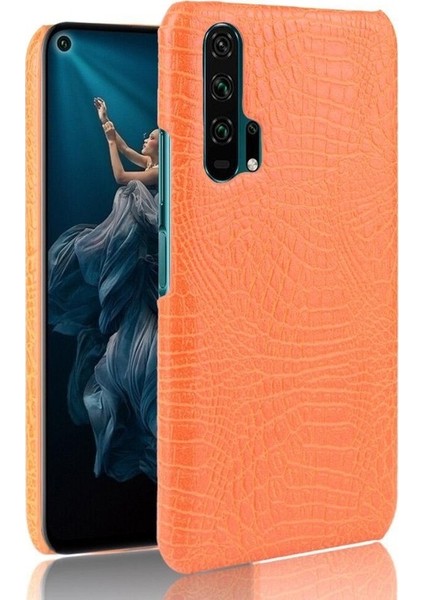 Onur 20 Pro Klasik Timsah Moda Koruyucu Için Şık Klasik Durumda (Yurt Dışından)